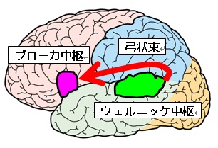 脳[1]