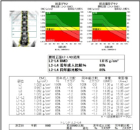 腰椎での測定結果