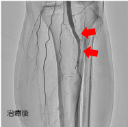 四肢領域