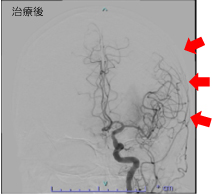 頭頚部領域